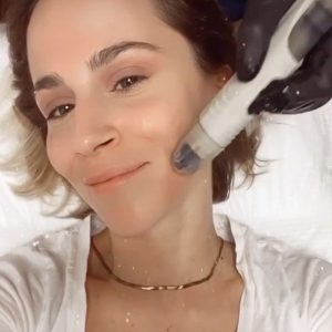 Θεραπείες 5 αστέρων στην Kosmesis: Τι κάνουν τα διάσημα #KosmesisGirls και #KosmesisBoys