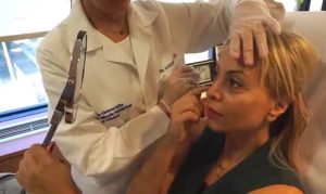 Fillers για νεανικά ζυγωματικά & πλούσια χείλη