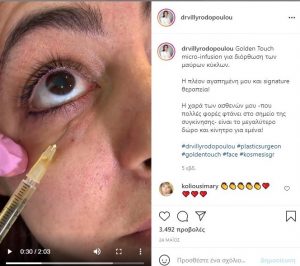 Φρέσκο πρόσωπο στις διακοπές με ενέσιμες θεραπείες στο παρά 5΄