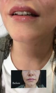 Έρχεται η πολυαναμενόμενη signature σειρά προϊόντων της συν-ιδρύτριας του Kosmesis Δρ. Βίλλυς Ροδοπούλου!