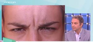 Ανανέωση του προσώπου χωρίς νυστέρι με την τεχνική Sfumato