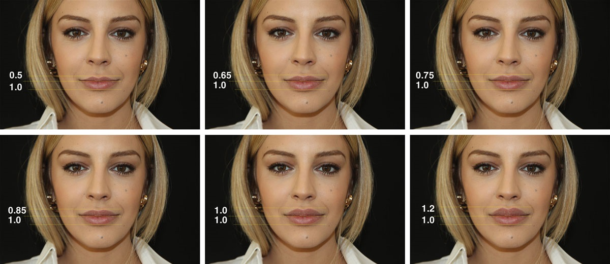 Παγκόσμια διάκριση του Kosmesis για τη Step-by-Step Φ Technique!