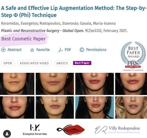 Φυσικά, καλοσχηματισμένα χείλη: Τι κάνει την Step-by-Step Φ Technique μοναδική