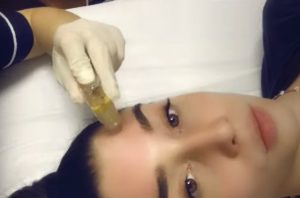 Ποια συνδυαστική αντιγηραντική θεραπεία προτείνει η Δρ. Βίλλυ Ροδοπούλου για κορυφαία αποτελέσματα;