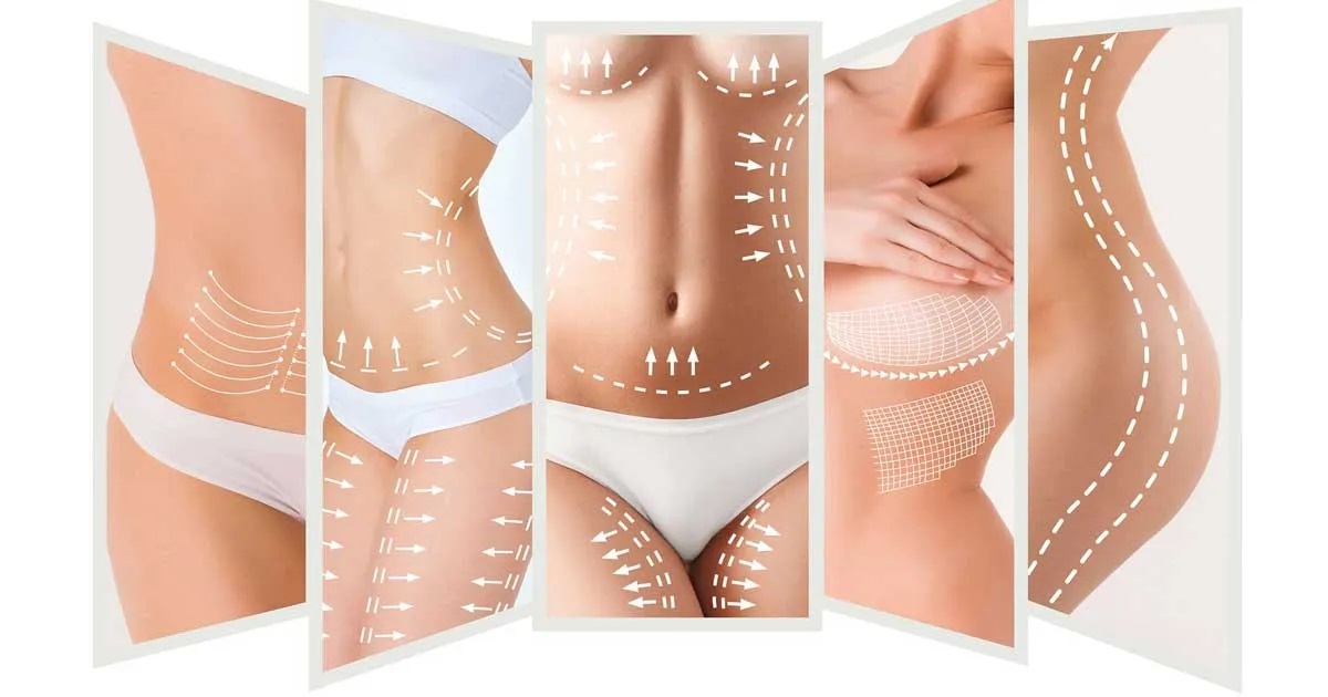 American Society of Plastic Surgeons: Αυτές ήταν οι πιο δημοφιλείς αισθητικές επεμβάσεις το 2022!