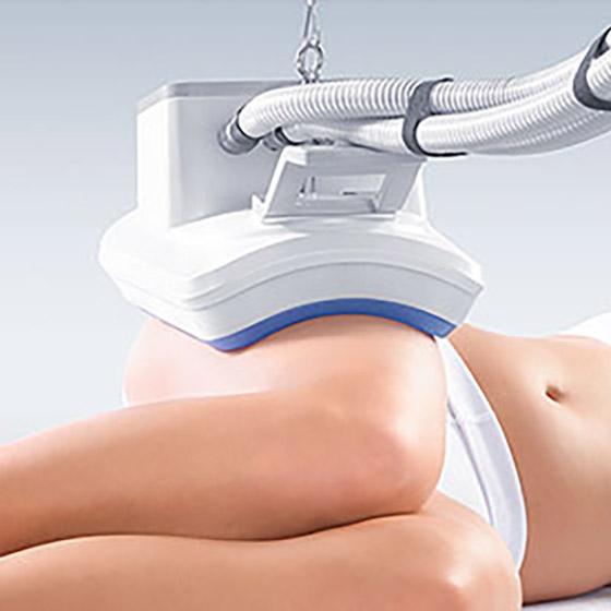 Κρυολιπόλυση 3D™ Κρυολιπόλυση 3D™