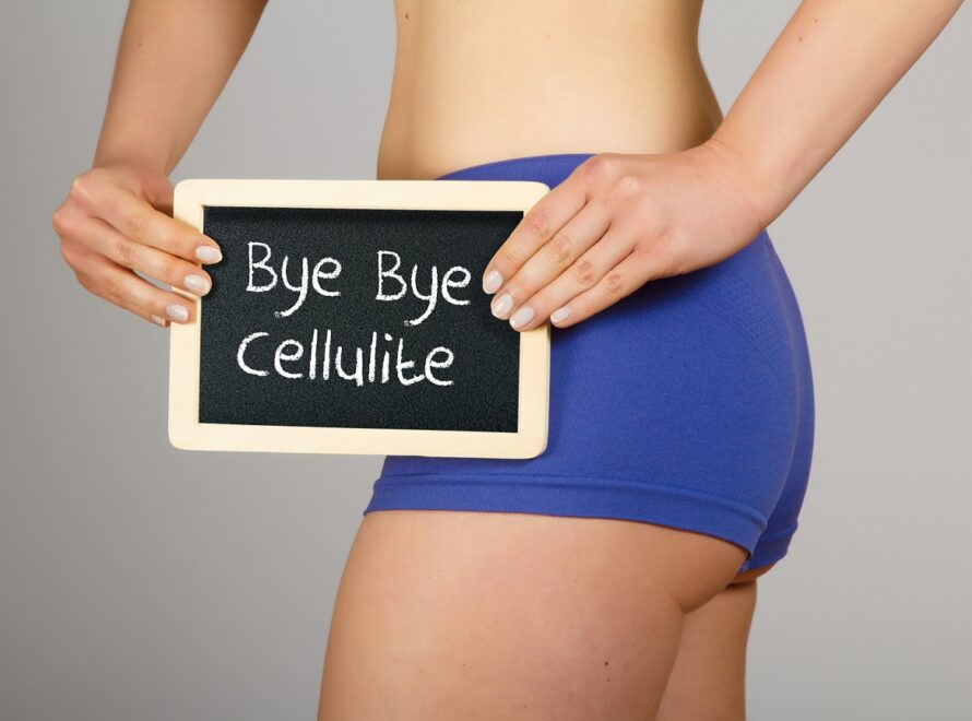 Κωδικός κυτταρίτιδα: Τα... σοφά κορίτσια ξεκινούν τώρα τη θεραπεία που τη νικά