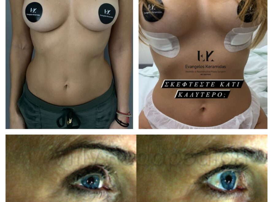 Φωτογραφίες ΠΡΙΝ-ΜΕΤΑ: Τα αποτελέσματά μας μιλούν για τη δουλειά μας