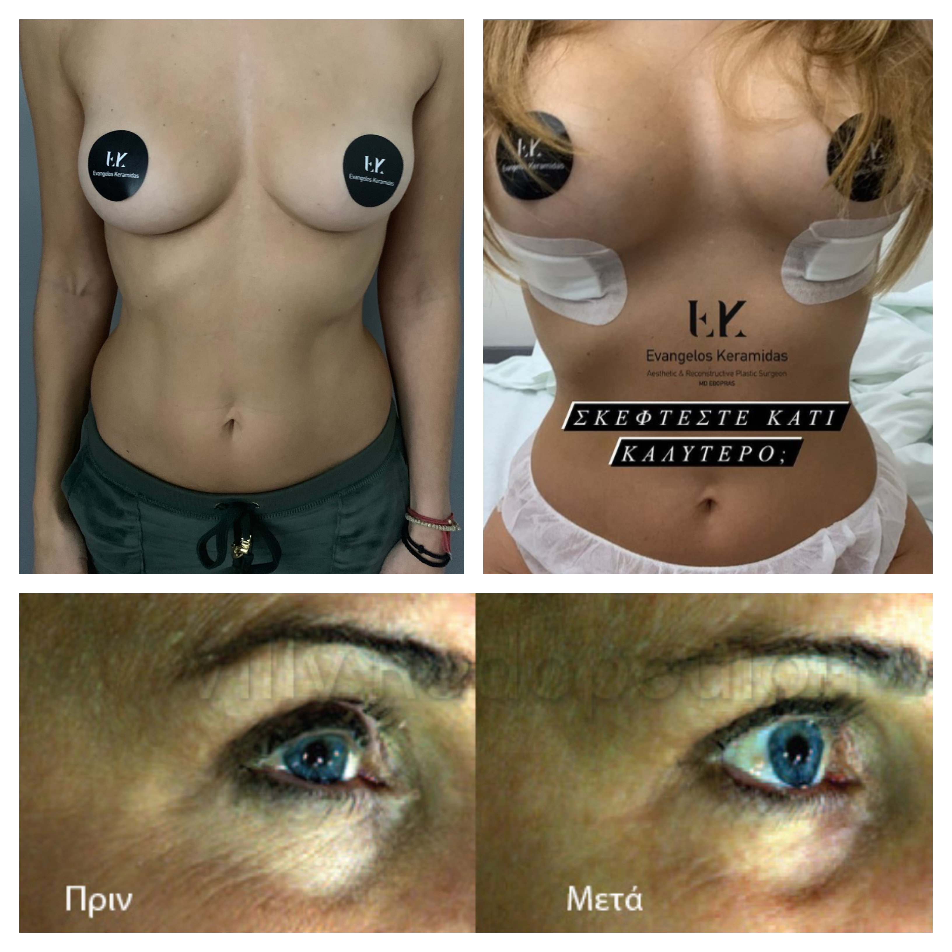 Φωτογραφίες ΠΡΙΝ-ΜΕΤΑ: Τα αποτελέσματά μας μιλούν για τη δουλειά μας Φωτογραφίες ΠΡΙΝ-ΜΕΤΑ: Τα αποτελέσματά μας μιλούν για τη δουλειά μας