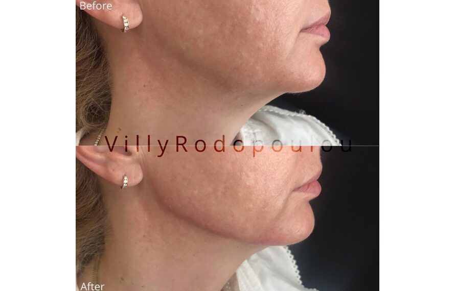 jawline τι ειναι