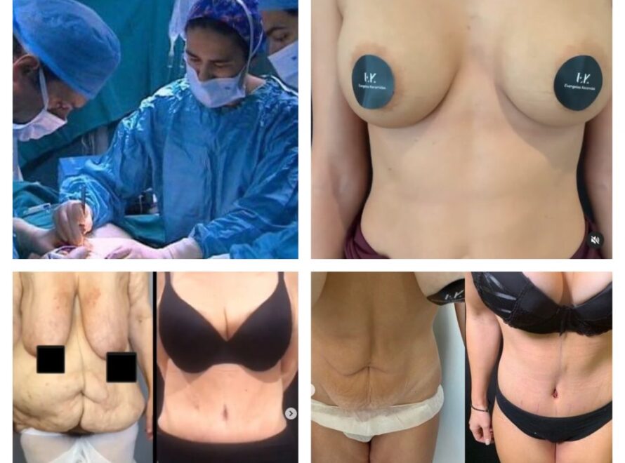 Οι πλαστικες επεμβασεις αυξανουν την αυτοπεποιθηση; Απαντουν 7 ασθενεις μας