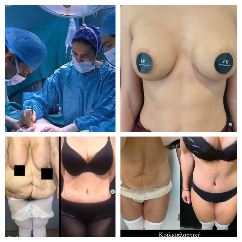 Οι πλαστικες επεμβασεις αυξανουν την αυτοπεποιθηση; Απαντουν 7 ασθενεις μας Οι πλαστικες επεμβασεις αυξανουν την αυτοπεποιθηση; Απαντουν 7 ασθενεις μας