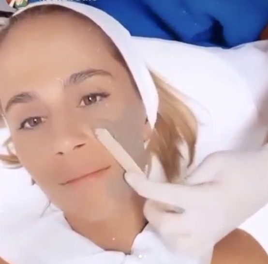 Μήπως ήρθε η ώρα για πίλινγκ; Η must θεραπεία ανανέωσης του δέρματος