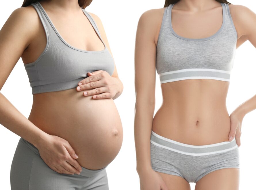 Mommy Makeover: Αγαπώ το μωρό μου αλλά φροντίζω και το σώμα μου