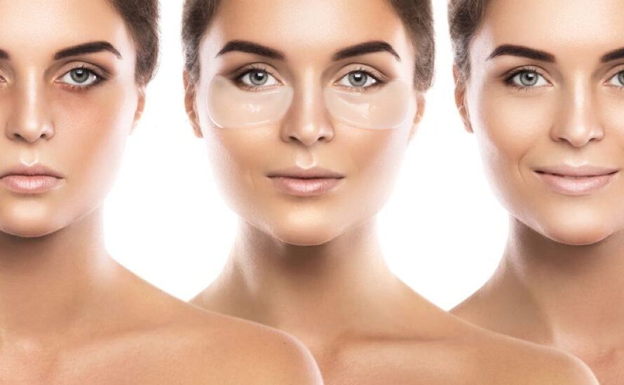 Μαύροι κύκλοι στα μάτια: Γίνονται παρελθόν με μία μόνο θεραπεία!