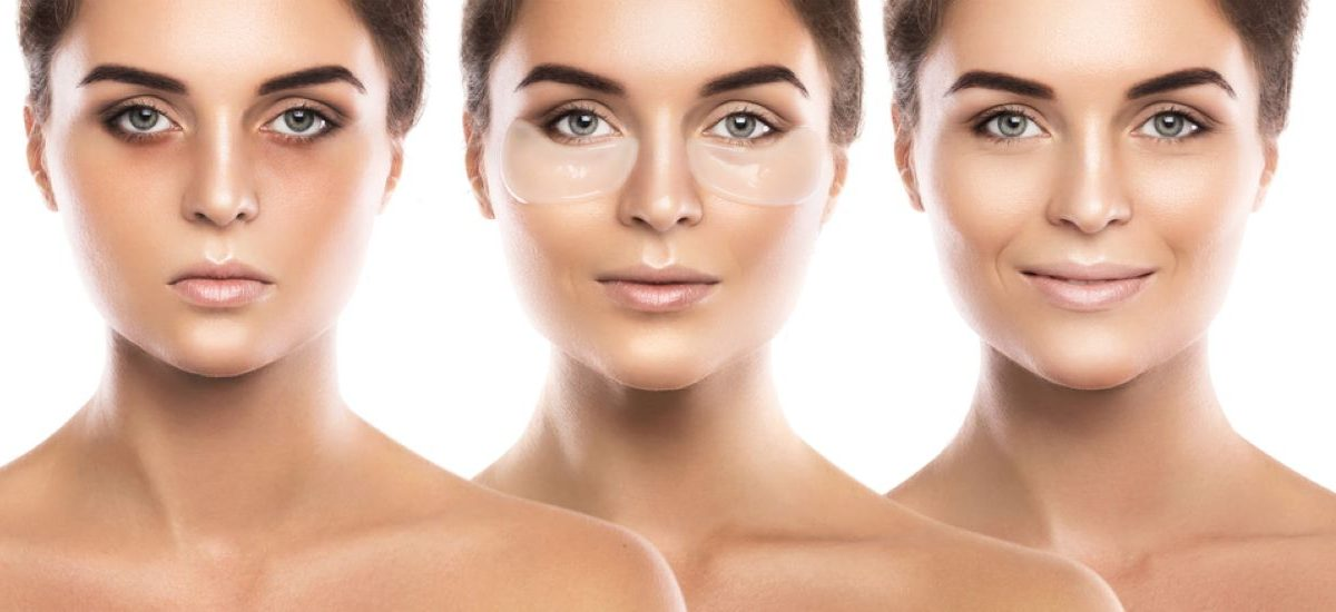 Μαύροι κύκλοι στα μάτια: Γίνονται παρελθόν με μία μόνο θεραπεία!