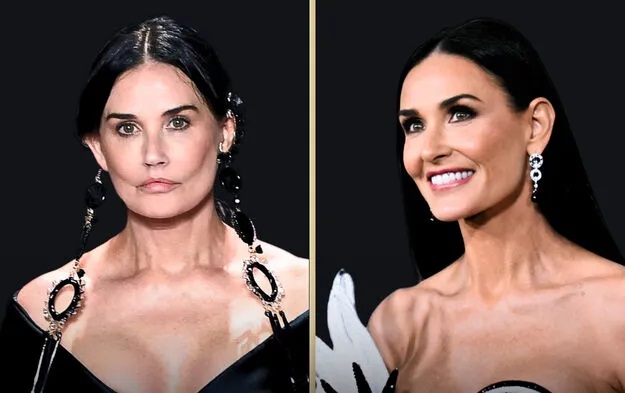 Στο Microneedling με Εξωσώματα χρωστά την εντυπωσιακή της ανανέωση η Demi Moore! Στο Microneedling με Εξωσώματα χρωστά την εντυπωσιακή της ανανέωση η Demi Moore!